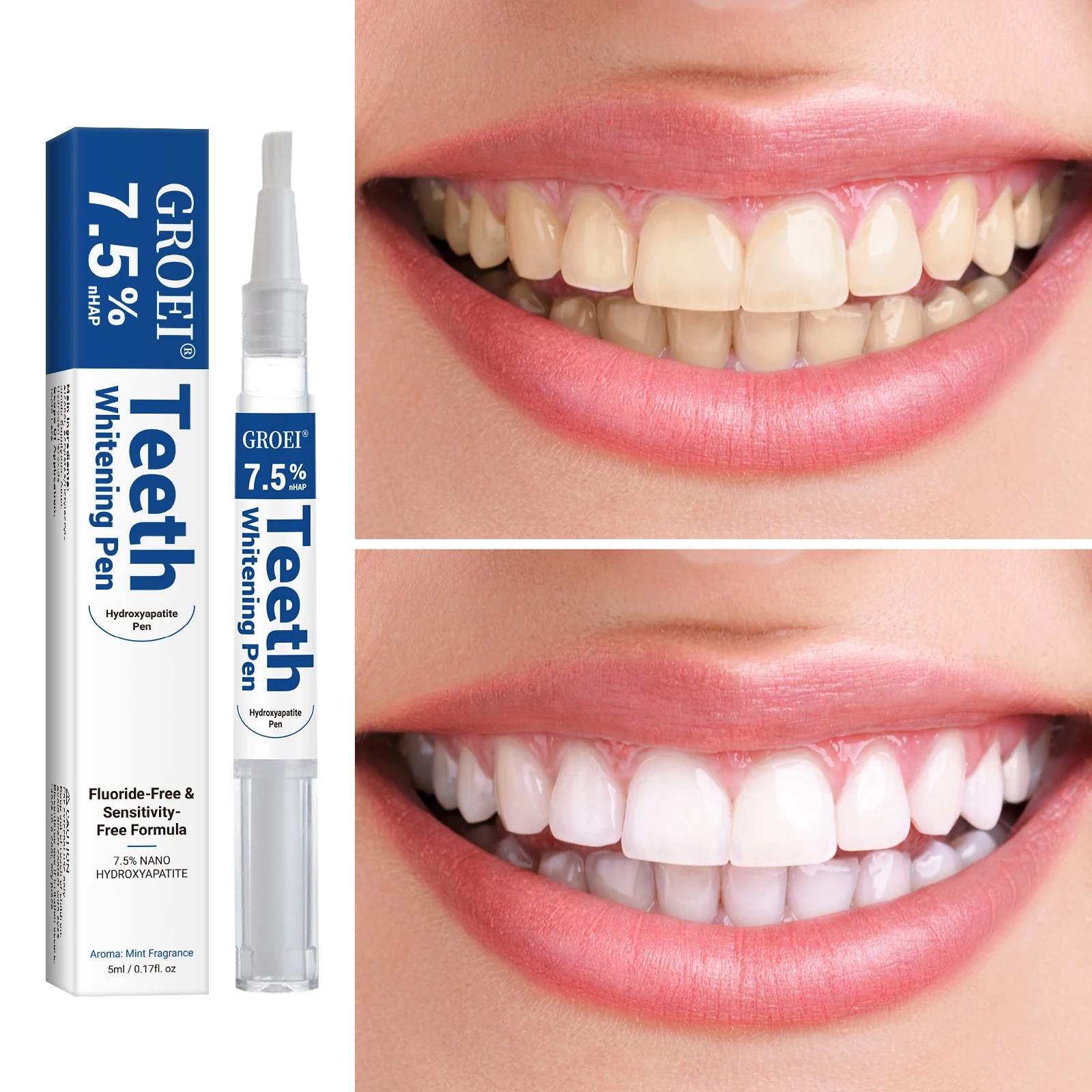 Hydroxyapatite Tooth Whitening - огляд і ціна Teeth Whitening Pens