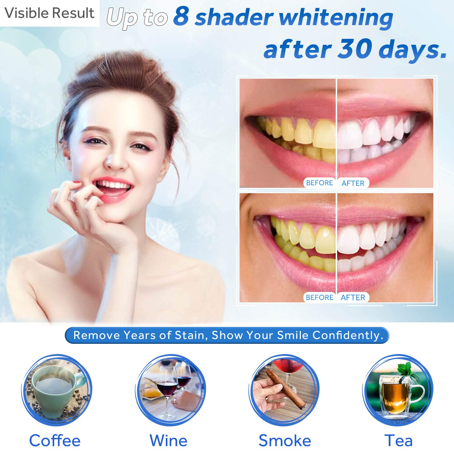 Teeth Whitening Gel Refill Syr - огляд і ціна Teeth Whitening Pens