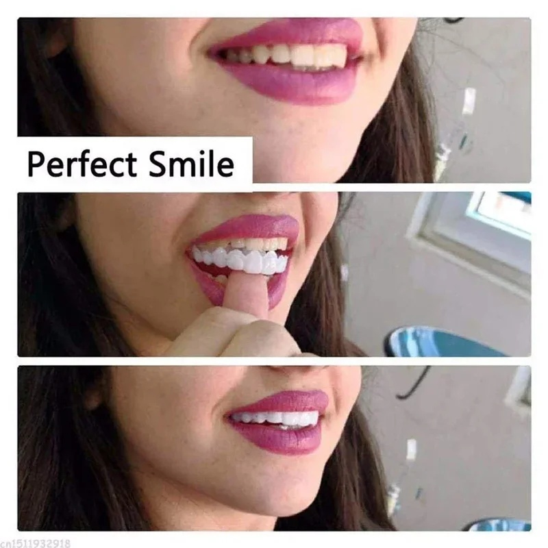 Snap-on Veneer Teeth Kit Adjus - огляд і ціна Teeth Whitening Kit
